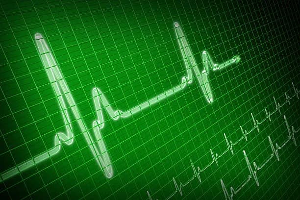 Electrocardiogram (ECG)