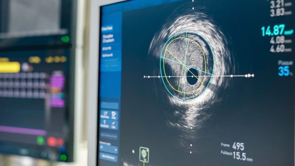 Ultrasound (Abdominal & Transvaginal)